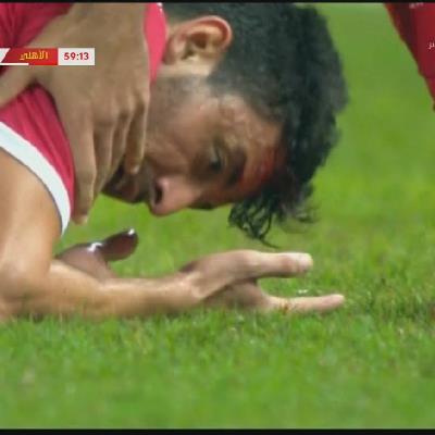 إصابة دموية لطاهر محمد طاهر في نهائي كأس مصر